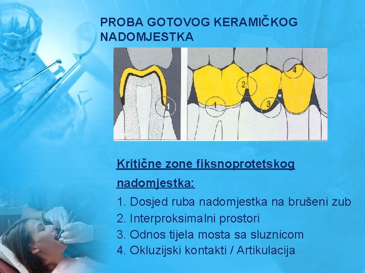 PROBA GOTOVOG KERAMIČKOG NADOMJESTKA Kritične zone fiksnoprotetskog nadomjestka: 1. Dosjed ruba nadomjestka na brušeni