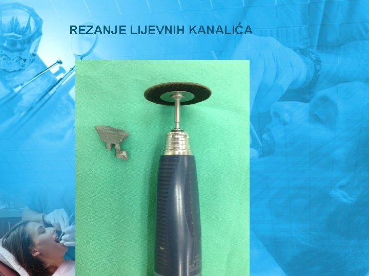 REZANJE LIJEVNIH KANALIĆA ¸ 