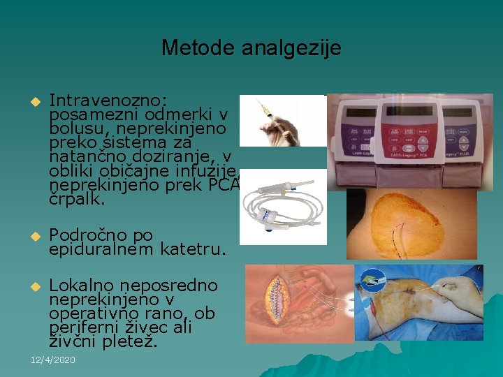 Metode analgezije u Intravenozno: posamezni odmerki v bolusu, neprekinjeno preko sistema za natančno doziranje,