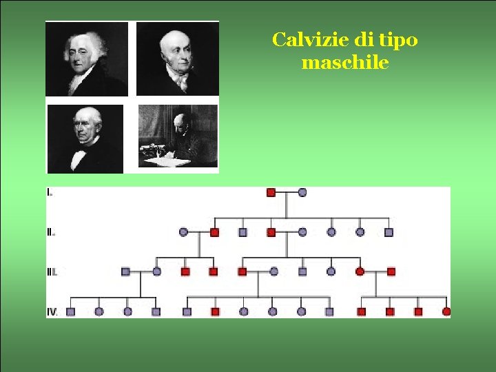 Calvizie di tipo maschile 