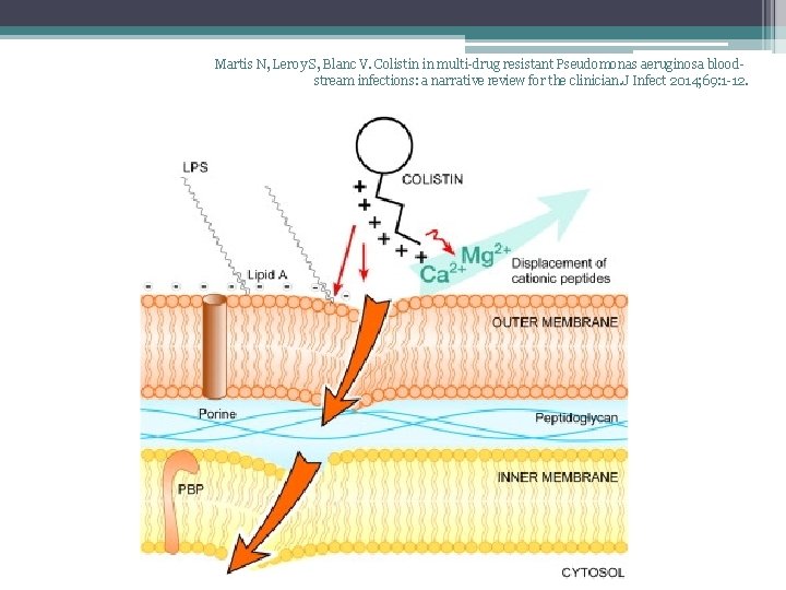 Martis N, Leroy S, Blanc V. Colistin in multi-drug resistant Pseudomonas aeruginosa bloodstream infections: