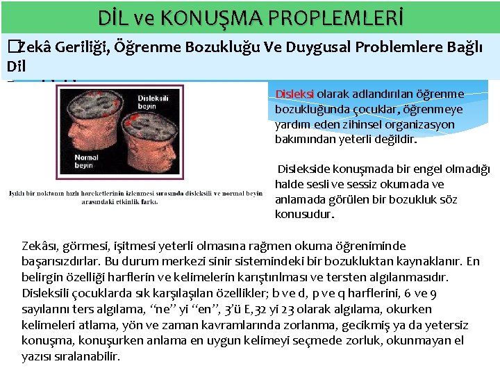 DİL ve KONUŞMA PROPLEMLERİ � Zekâ Geriliği, Öğrenme Bozukluğu Ve Duygusal Problemlere Bağlı Dil