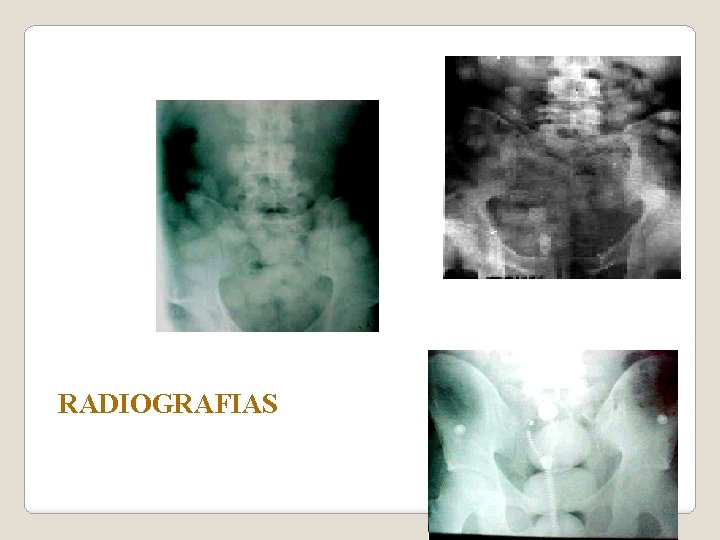 RADIOGRAFIAS 