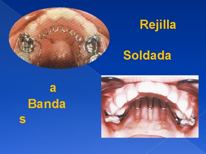 Rejilla Soldada a Banda s 