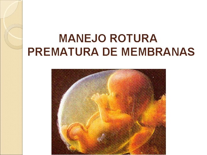 MANEJO ROTURA PREMATURA DE MEMBRANAS 