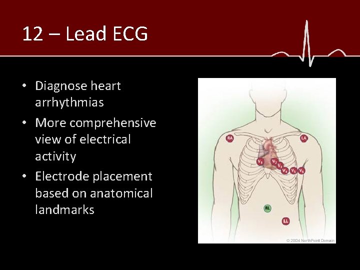 12 – Lead ECG • Diagnose heart arrhythmias • More comprehensive view of electrical