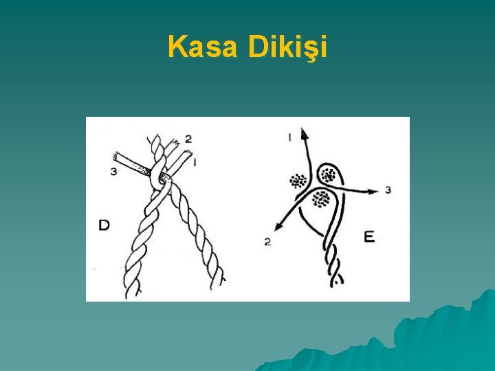 Kasa Dikişi 