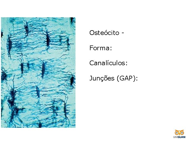 Osteócito Forma: Canalículos: Junções (GAP): 