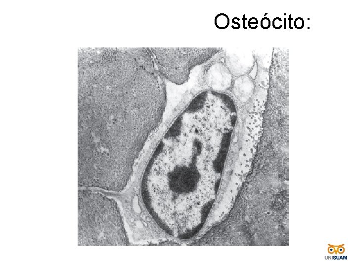  Osteócito: 