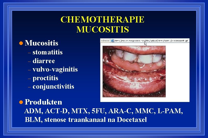 CHEMOTHERAPIE MUCOSITIS l Mucositis stomatitis – diarree – vulvo-vaginitis – proctitis – conjunctivitis –