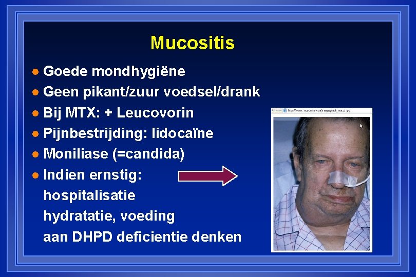 Mucositis Goede mondhygiëne l Geen pikant/zuur voedsel/drank l Bij MTX: + Leucovorin l Pijnbestrijding: