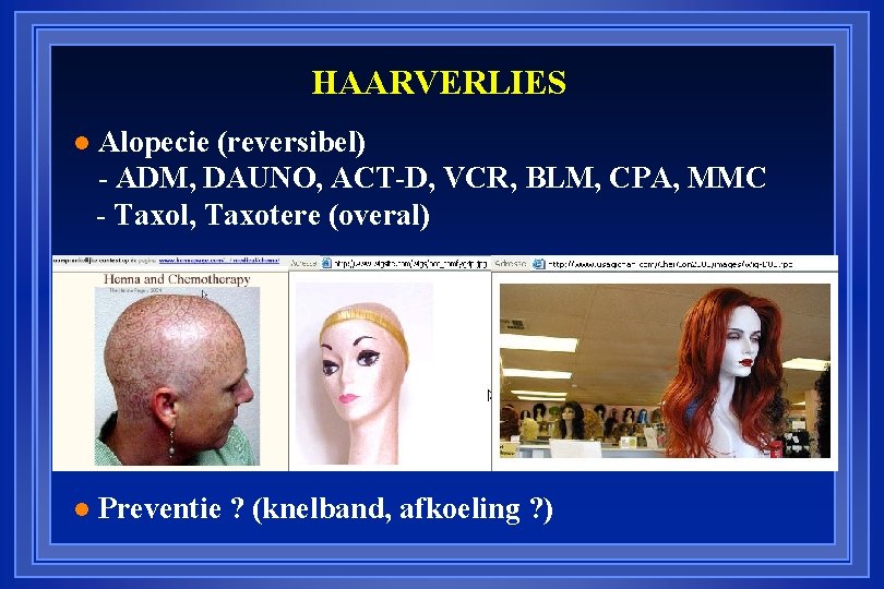 HAARVERLIES Alopecie (reversibel) - ADM, DAUNO, ACT-D, VCR, BLM, CPA, MMC - Taxol, Taxotere