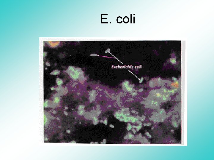 E. coli 