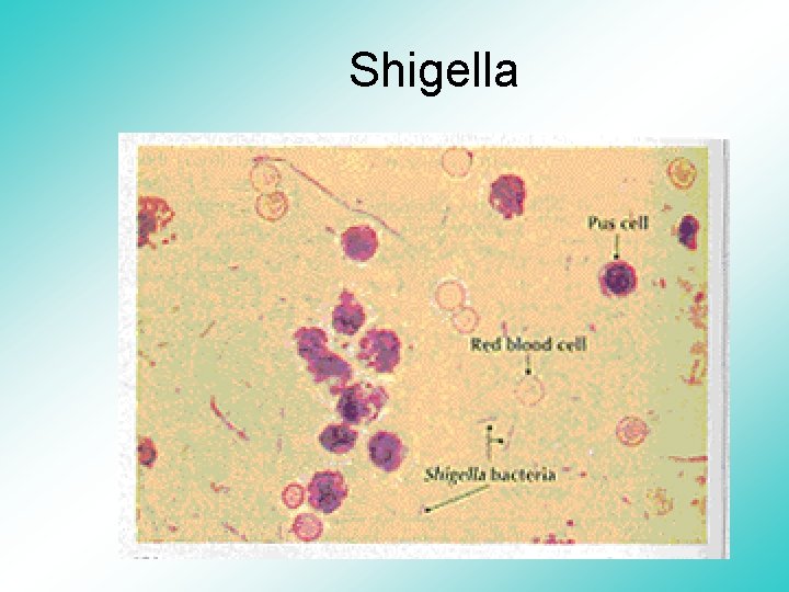 Shigella 