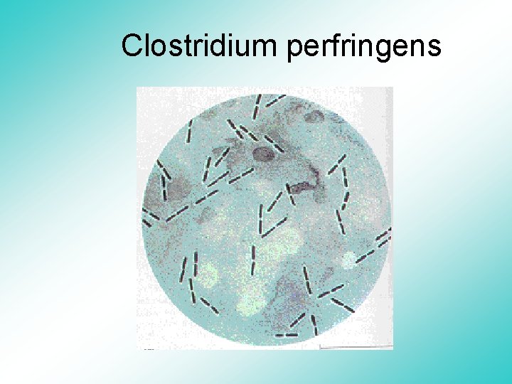 Clostridium perfringens 