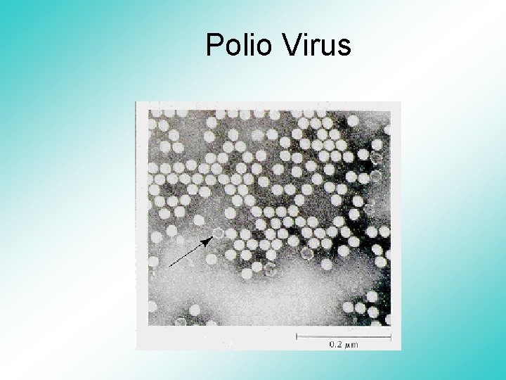 Polio Virus 
