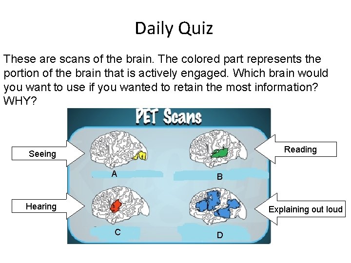 Daily Quiz These are scans of the brain. The colored part represents the portion