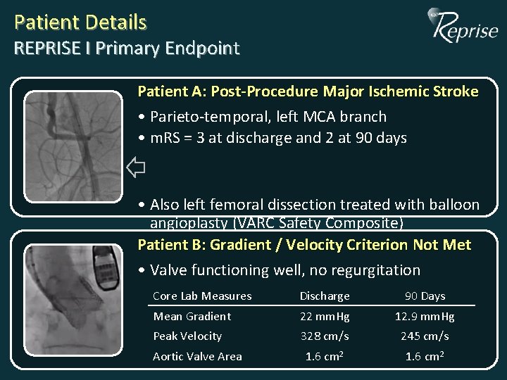 Patient Details REPRISE I Primary Endpoint Patient A: Post-Procedure Major Ischemic Stroke • Parieto-temporal, Patient Details REPRISE I Primary Endpoint Patient A: Post-Procedure Major Ischemic Stroke • Parieto-temporal,
