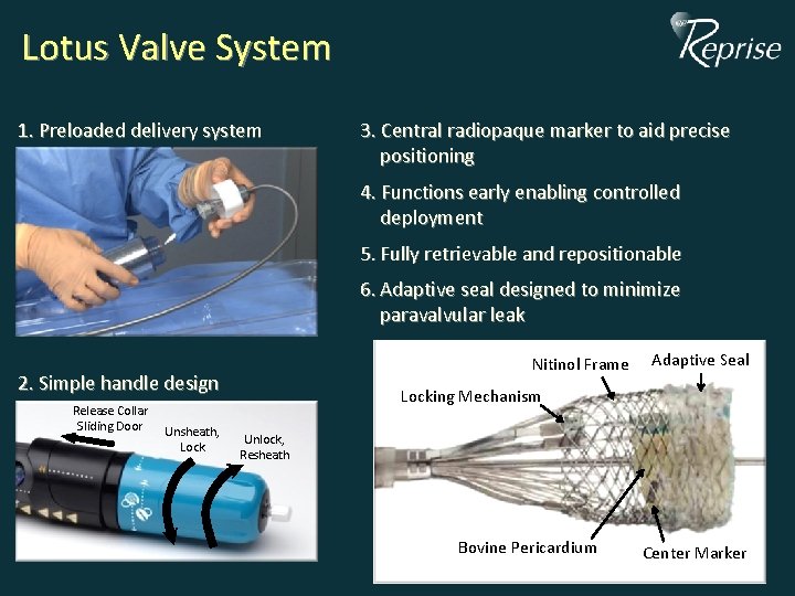 Lotus Valve System 1. Preloaded delivery system 3. Central radiopaque marker to aid precise Lotus Valve System 1. Preloaded delivery system 3. Central radiopaque marker to aid precise