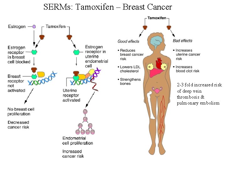 SERMs: Tamoxifen – Breast Cancer 2 -3 fold increased risk of deep vein thrombosis