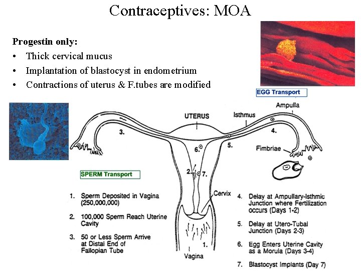Contraceptives: MOA Progestin only: • Thick cervical mucus • Implantation of blastocyst in endometrium