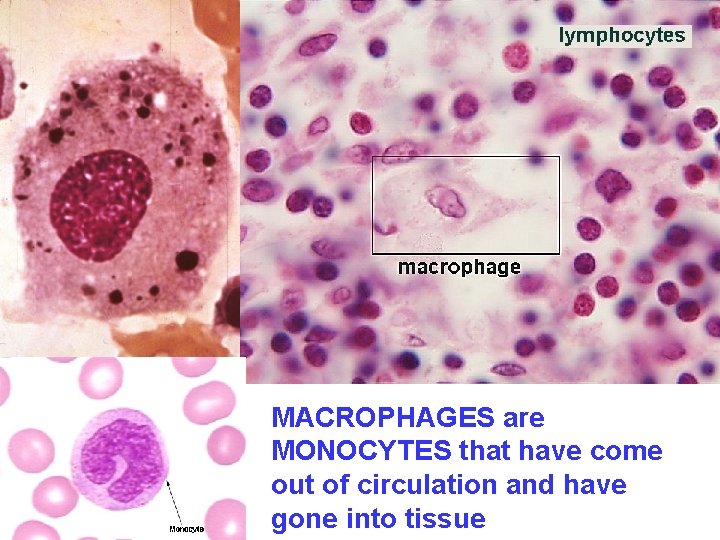 MACROPHAGES are MONOCYTES that have come out of circulation and have gone into tissue