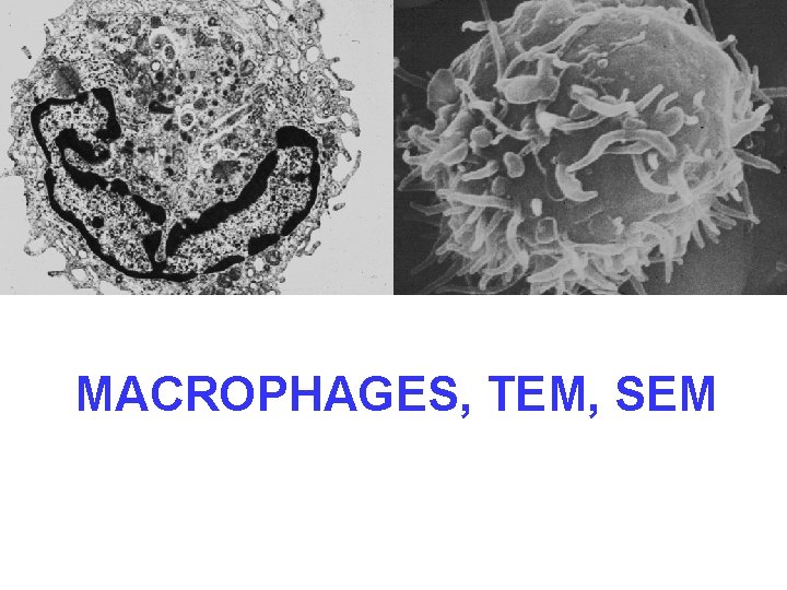 MACROPHAGES, TEM, SEM 