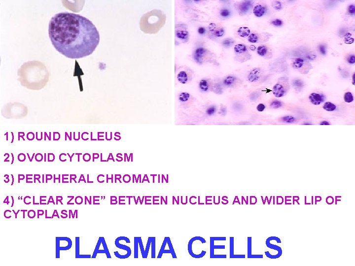 1) ROUND NUCLEUS 2) OVOID CYTOPLASM 3) PERIPHERAL CHROMATIN 4) “CLEAR ZONE” BETWEEN NUCLEUS