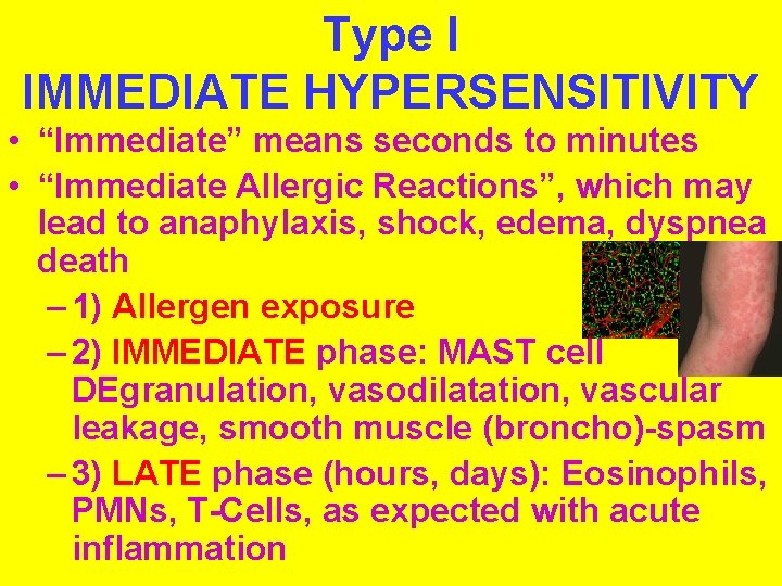 Type I IMMEDIATE HYPERSENSITIVITY • “Immediate” means seconds to minutes • “Immediate Allergic Reactions”,