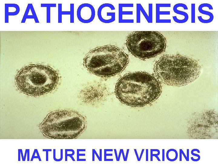 PATHOGENESIS MATURE NEW VIRIONS 