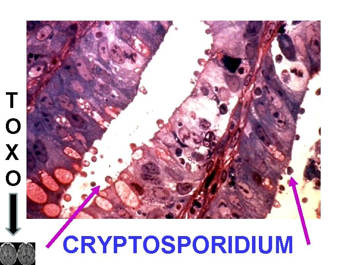 T O X O CRYPTOSPORIDIUM 