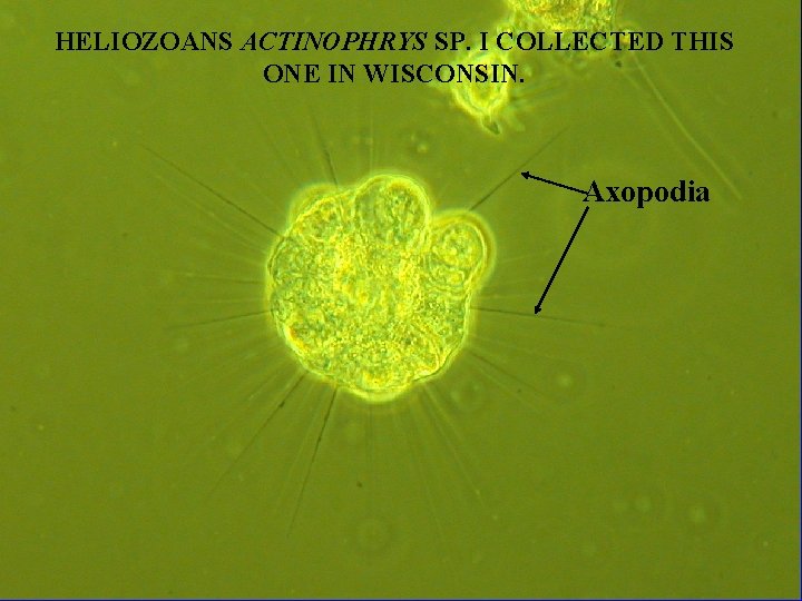 HELIOZOANS ACTINOPHRYS SP. I COLLECTED THIS ONE IN WISCONSIN. Axopodia 