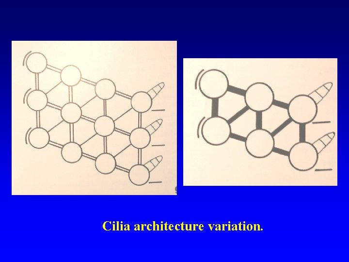 Cilia architecture variation. 