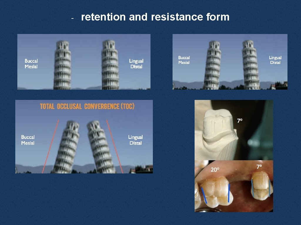 - retention and resistance form 