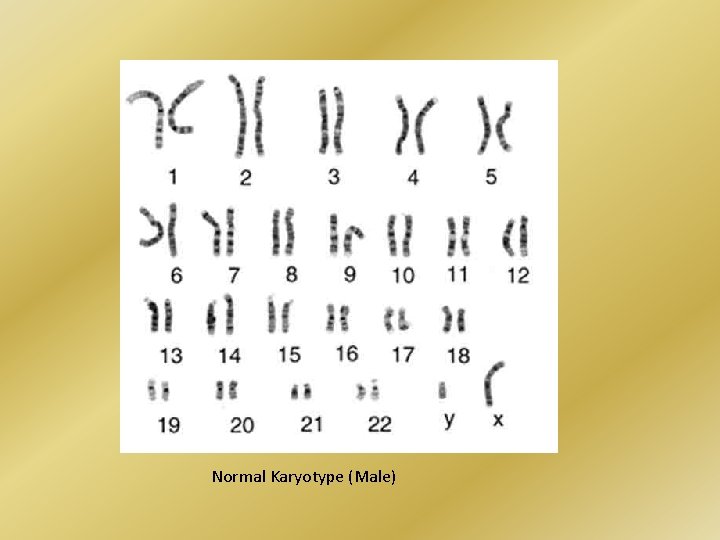 Normal Karyotype (Male) 