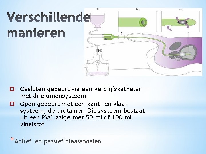 o Gesloten gebeurt via een verblijfskatheter met drielumensysteem o Open gebeurt met een kant-