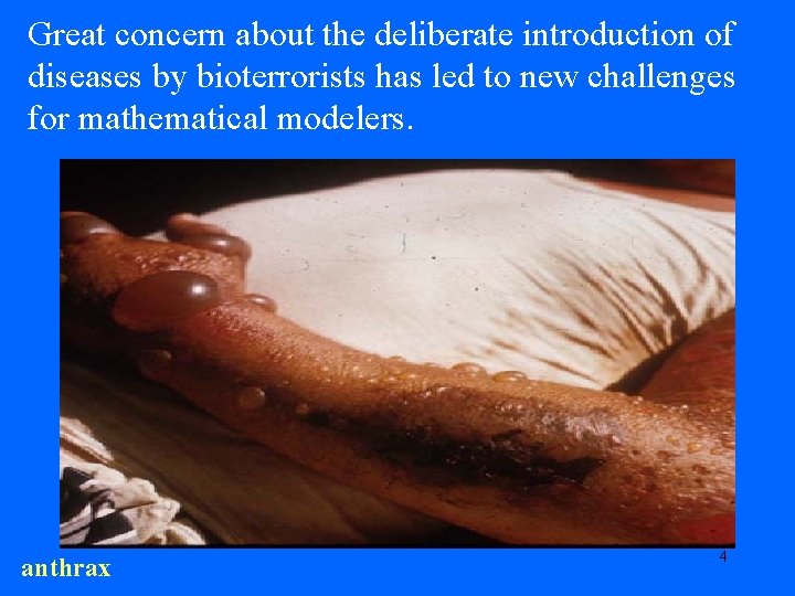 Great concern about the deliberate introduction of diseases by bioterrorists has led to new