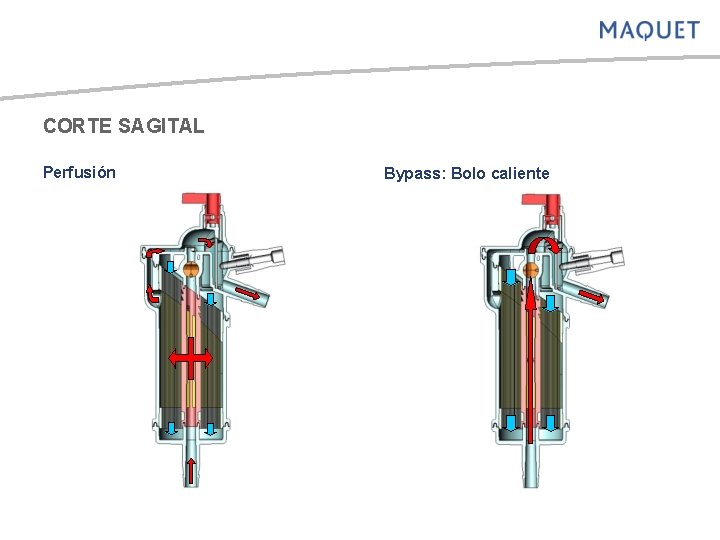 CORTE SAGITAL Perfusión Bypass: Bolo caliente 