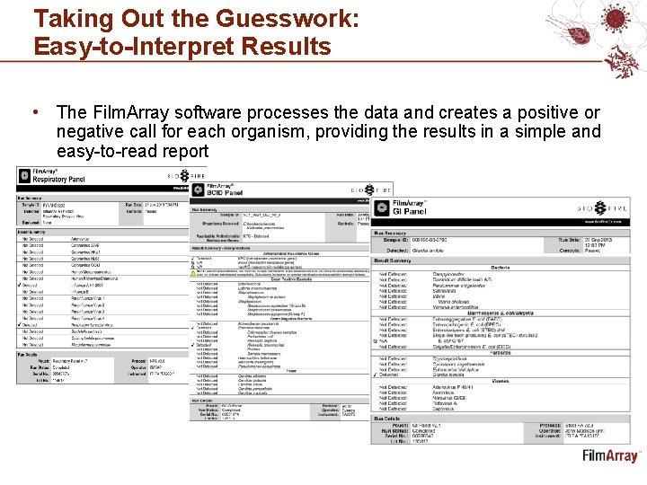 Taking Out the Guesswork: Easy-to-Interpret Results • The Film. Array software processes the data