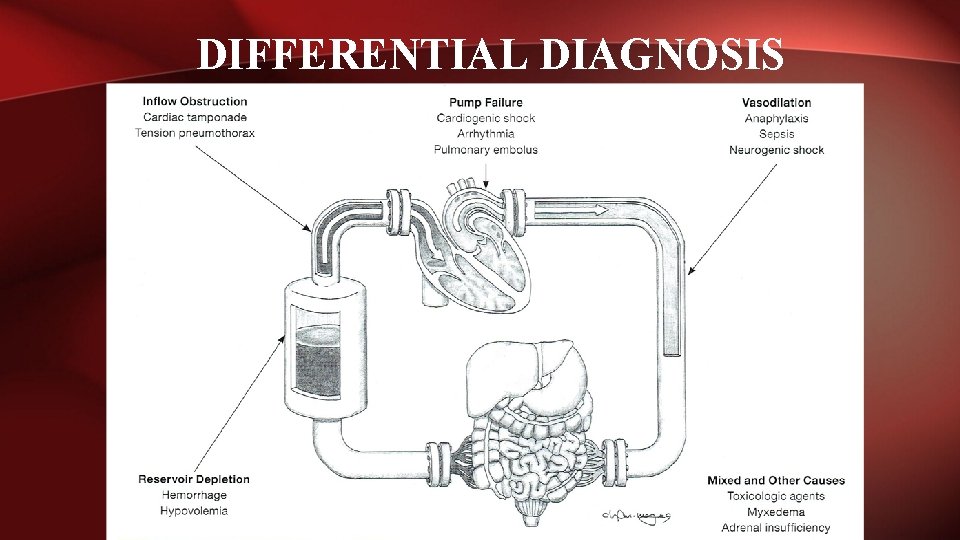 DIFFERENTIAL DIAGNOSIS 