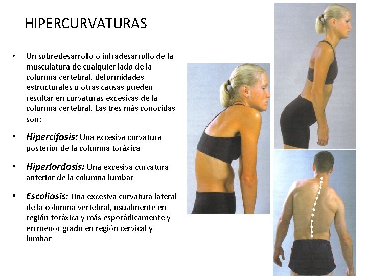 HIPERCURVATURAS • Un sobredesarrollo o infradesarrollo de la musculatura de cualquier lado de la