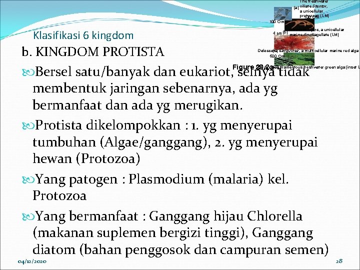 The freshwater (a) ciliate Stentor, a unicellular protozoan 100 m (LM) 100 m Klasifikasi