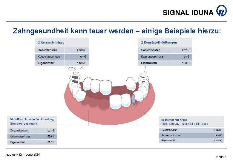 Zahngesundheit kann teuer werden – einige Beispiele hierzu: exclusiv für - concret 24 Folie