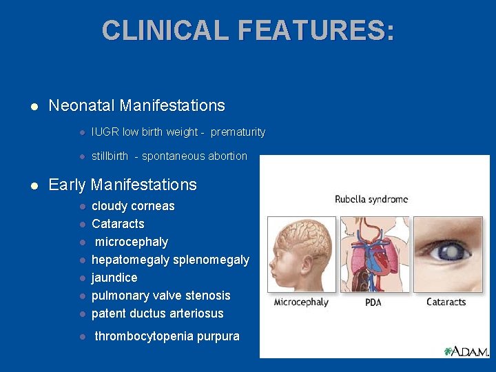 CLINICAL FEATURES: l l Neonatal Manifestations l IUGR low birth weight - prematurity l