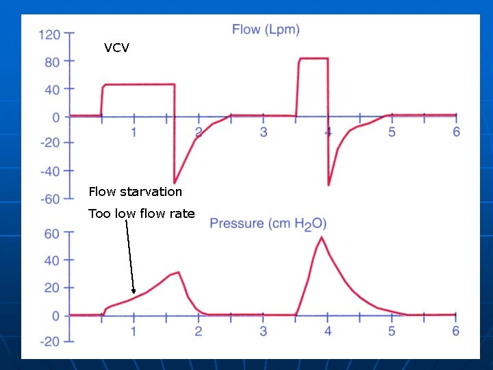 VCV Flow starvation Too low flow rate 