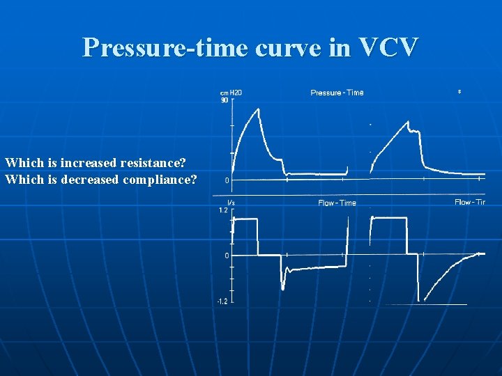 Pressure-time curve in VCV Which is increased resistance? Which is decreased compliance? 