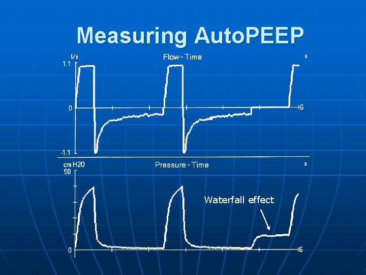Measuring Auto. PEEP Waterfall effect 