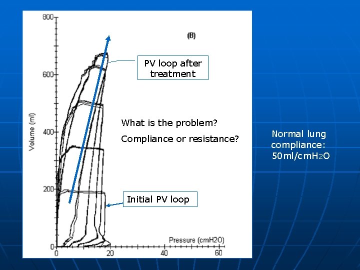 PV loop after treatment What is the problem? Compliance or resistance? Initial PV loop