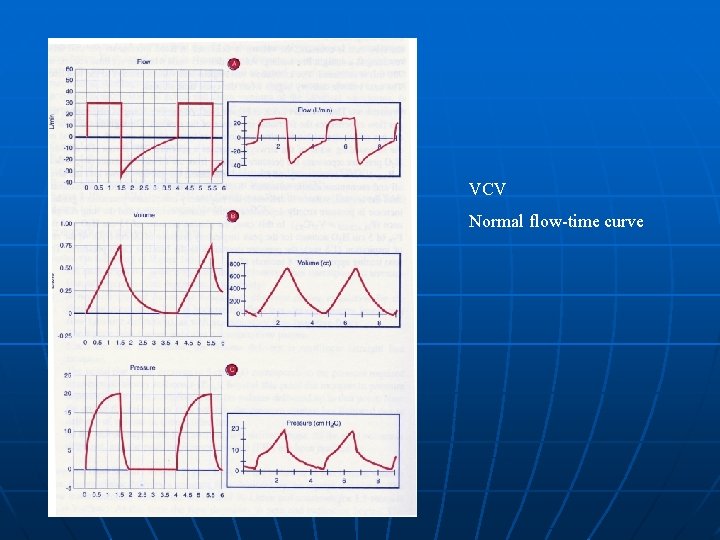 VCV Normal flow-time curve 