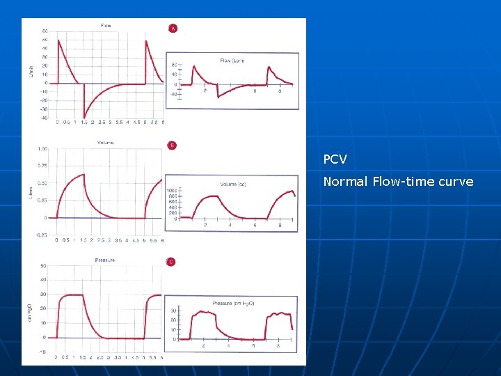 PCV Normal Flow-time curve 